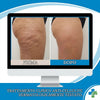 2 FLACONI 3D CELLULITE RESET