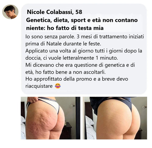 2 FLACONI 3D CELLULITE RESET